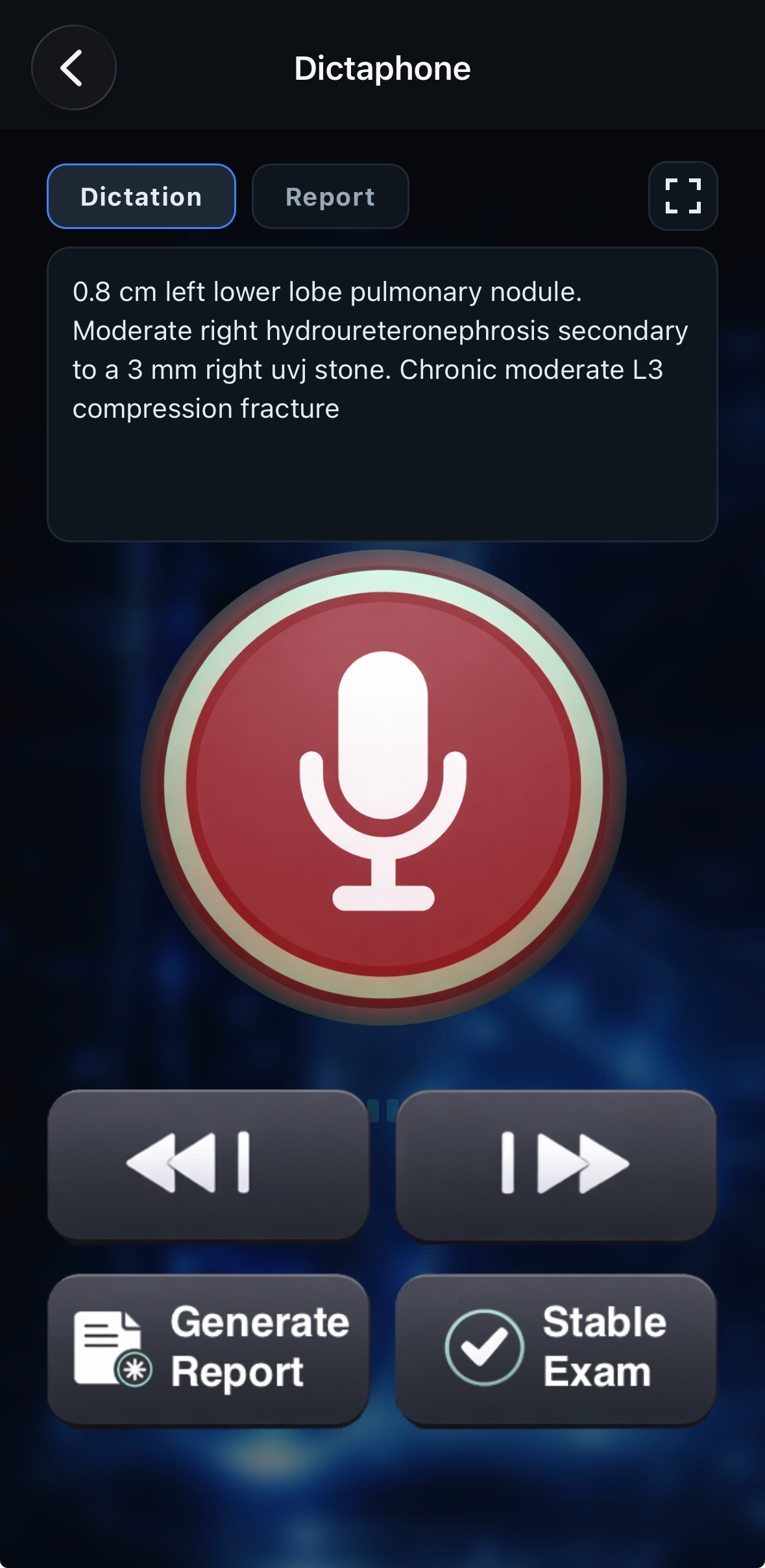 Shadowfax Mobile dictation controls